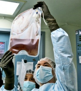 Technicians hold up a bag of modified T cells genetically edited to resist HIV infection. (Credit: Penn)