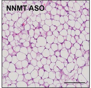 Fat cells after NNMT inhibition. Image: Qin Yang/BIDMC