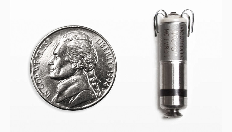 World’s tiniest pacemaker implanted without surgery
