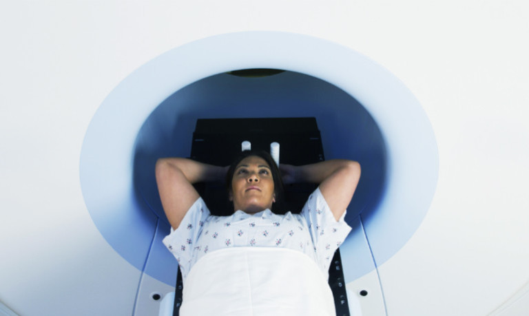 Do costly scans save lives after lung cancer?