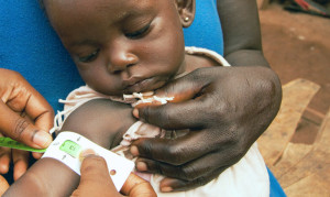 "The impaired growth we see in malnourished children was transmitted to the mice that received gut microbes from these children," Jeffrey Gordon says. "These differences in growth between the different groups of mice occurred even though they were consuming the same amount of food. The only difference between the groups was in the makeup of their human microbial communities." (Credit: Direct Relief/Flickr)