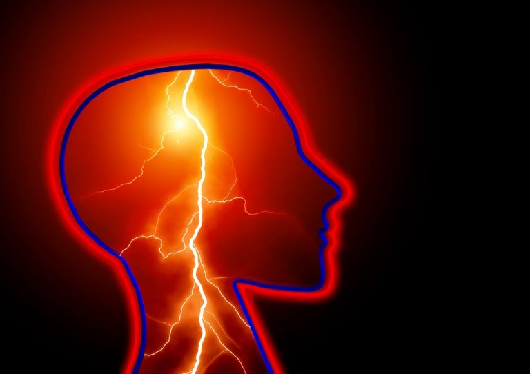 Pre-stroke risk factors influence long-term future stroke, dementia risk